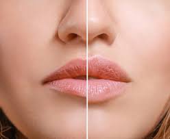 Lip Lining